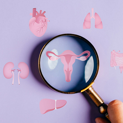 MCME-FERTILITY-SCREENING