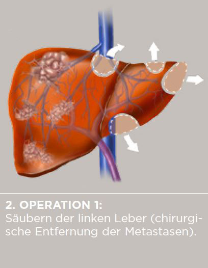 Diagramm der Leberarterie