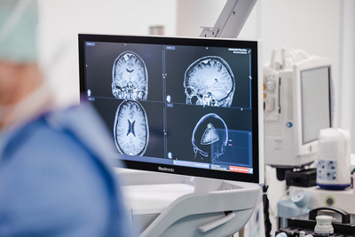 Radiographie - cerveau