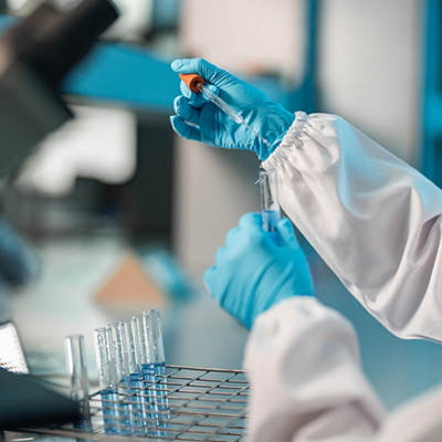 PSA Test vs. Digital Rectal Exam