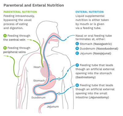 Parenteral and Enteral Nutrition