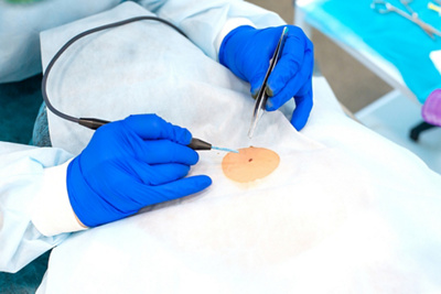 surgeon working on a patients skin