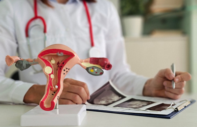 endometrial ablation graphic