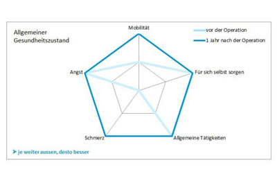 Proms-05-diagamm-spindel