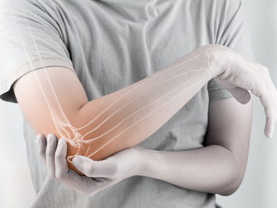 Rheumatoid-Arthritis