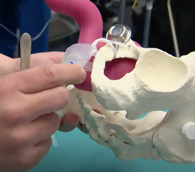 Schliessmuskelprothese nach Prostatakreb