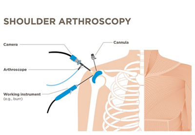 Shoulder, image of shoulder joint