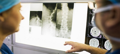 Scoliosis: Correcting the curve