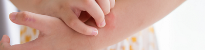 A parent’s guide to anaphylactic shock in children