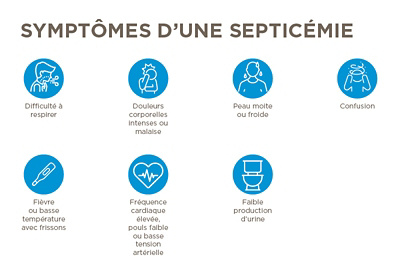 Sepsis_French