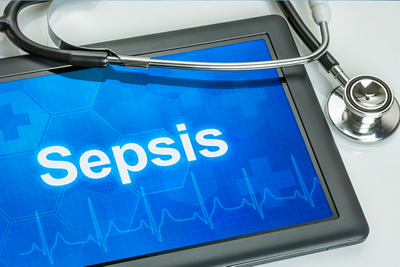 Sepsis_gettyimages-1152x768