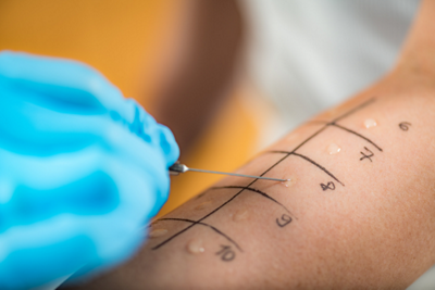 Skin Prick Test- 1152 x 768 - 1