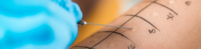 Skin prick testing for food allergies: What to expect