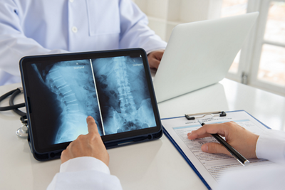 Spine_1152x768 - 1