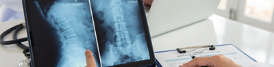 How to prevent spinal injuries, plus signs that you might need surgery