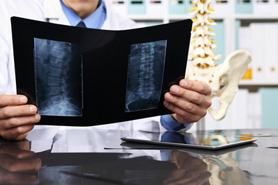 Spine_gettyimages-1152x768