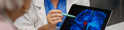 Understanding a TIA or “mini-stroke”