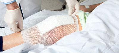 What to expect from a Total Knee Replacement
