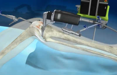 Hüftgelenk bei einem Skelett