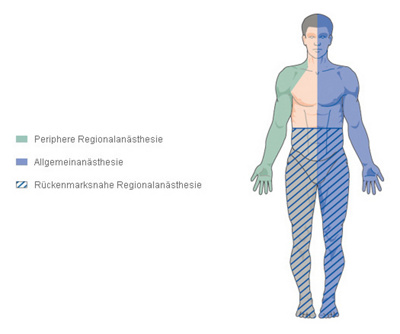 Beschreibung und Body Anästhesie