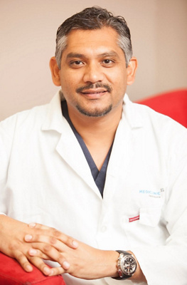 atrial fibrillation3