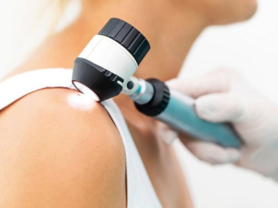 Examination of the skin