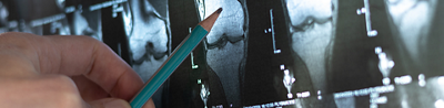 Your guide to bone density testing