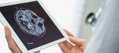 Double “awake” brain surgery milestone for Mediclinic Milnerton