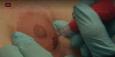 bz-biel-bern-puls-sendung-heilsame-tattoos