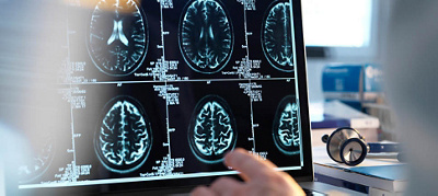 New cancer treatment technology at our fingertips