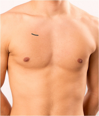 cc-cdc_mini_invasive_02