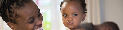 Child with cleft palate looking at camera