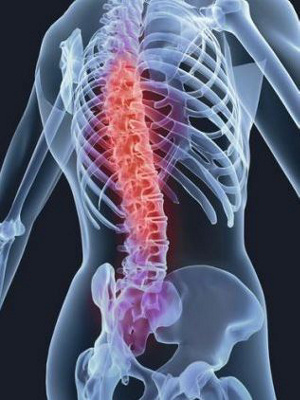 Colonne vertébrale - cervicales et lombaires