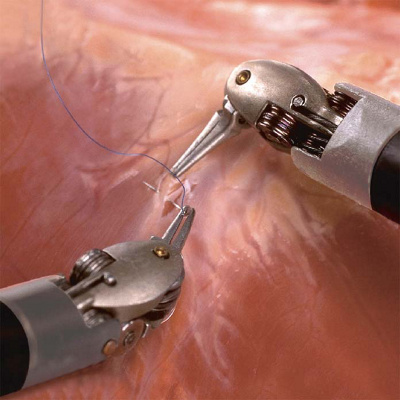 da-vinci-roboter_monitor