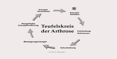 das-schmerzhafte-knie-was-tun-3