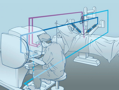davinciroboter-grafische-darstellung