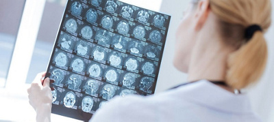 Meet SA’s first-ever female neurosurgeon