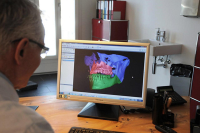 Arzt arbeitet an Kieferrekonstruktion am PC