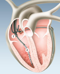 Forum herzschrittmacher Cardiology and