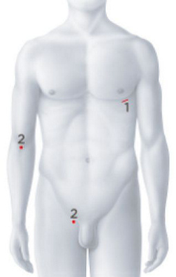 Operationszugänge Hybridverfahren