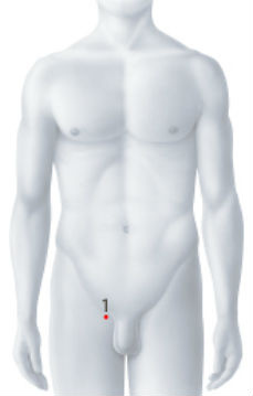 Operationszugang Mitraclip