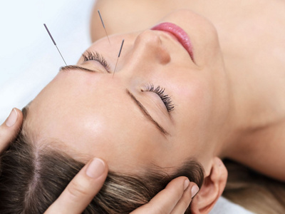 Frau während Akupunkturtherapie