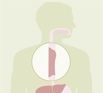 hirslanden-anatomie-speiseroehre