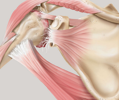 hirslanden-behandlung-von-funktionsstoerungen-der-schulter-1