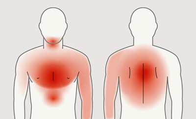 hirslanden-bei-einem-herzinfarkt-richtig-handeln-1