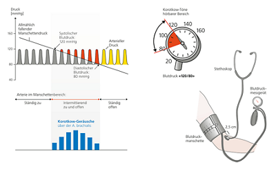 hirslanden-blutdruckmessung-2