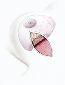 hirslanden-brustkrebs-fortschritte-bei-der-brusterhaltenden-operationstechnik-1