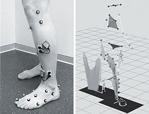 hirslanden-chronische-fussschmerzen-1