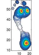 hirslanden-chronische-fussschmerzen-2