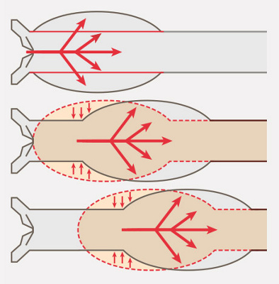 hirslanden-der-mensch-ist-so-jung-wie-seine-gefaesse-1